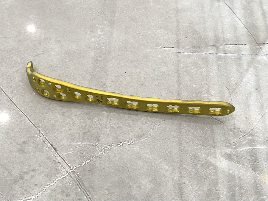 Plaque de verrouillage Olécrane