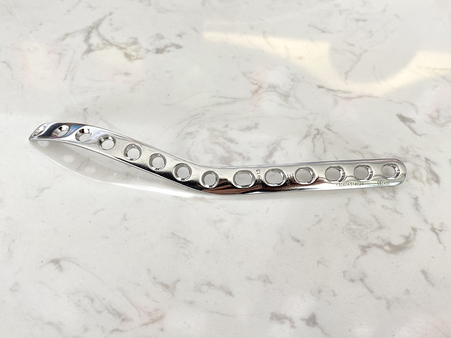 Plaque latérale humérale distale (type olécrâne)