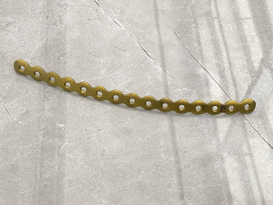 Plaque de verrouillage pour la reconstruction des c&ocirc;tes