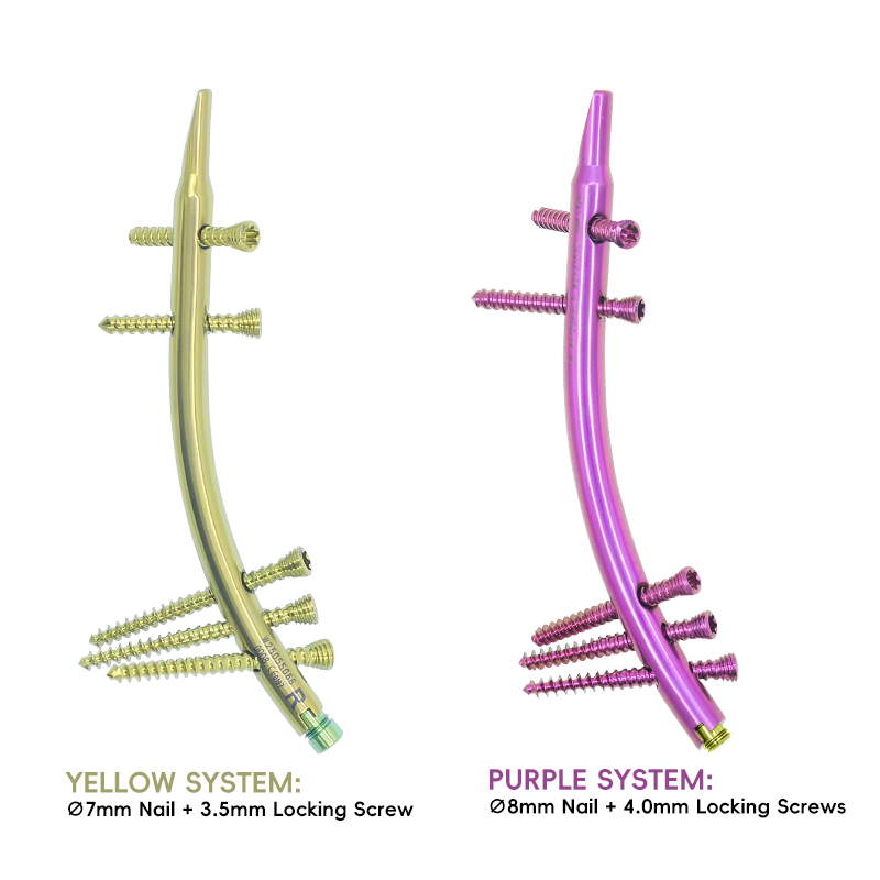 Ensemble d'instruments intramédullaire tibial distal (DTN)