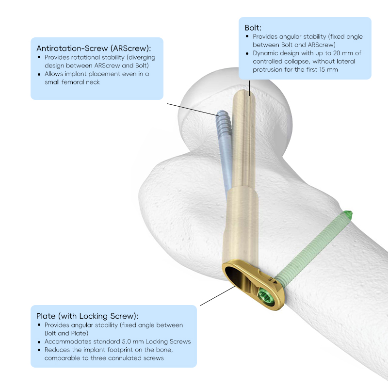 FNS (Système du col fémoral)