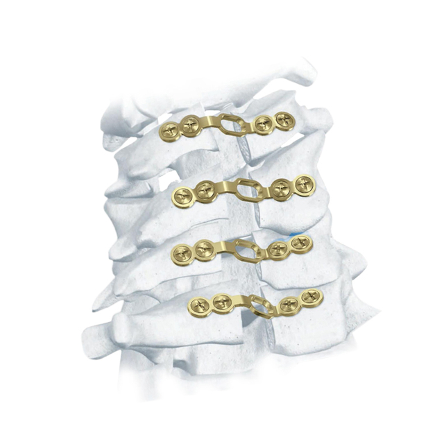 Système de laminoplastie cervicale postérieure