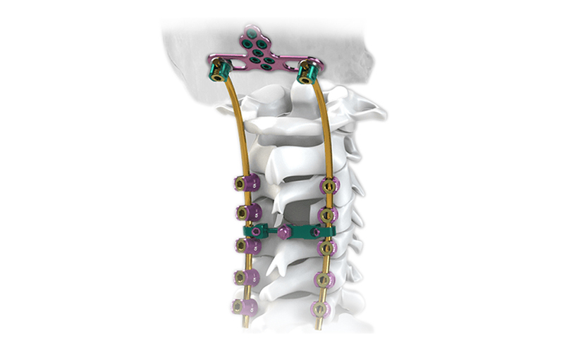 Système de vis postérieur-cervical