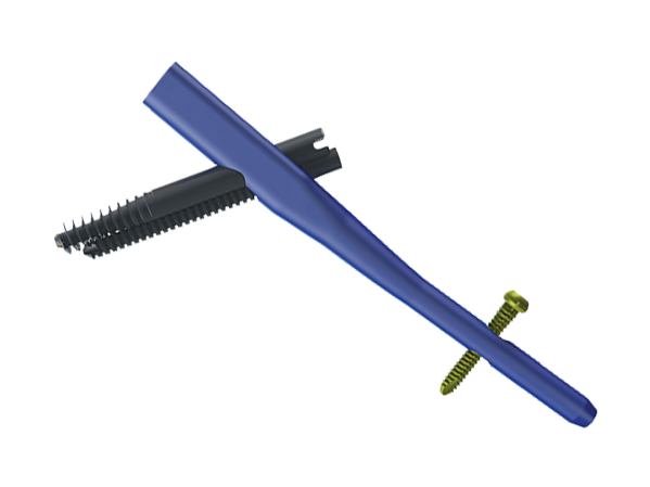 Clou intramédullaire