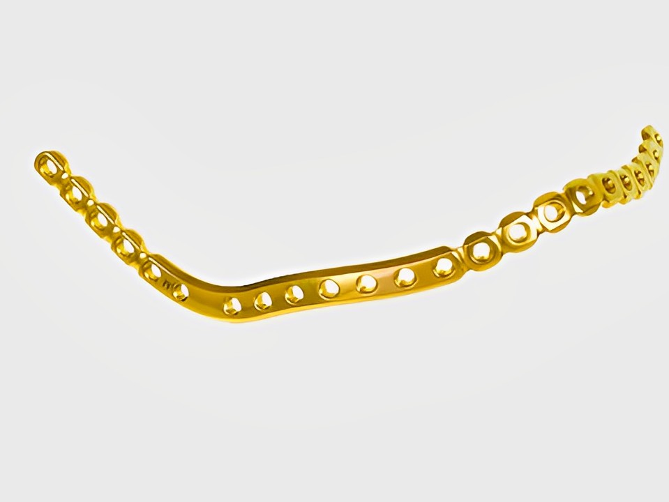 Plaque de verrouillage anatomique pour reconstruction maxillo-faciale