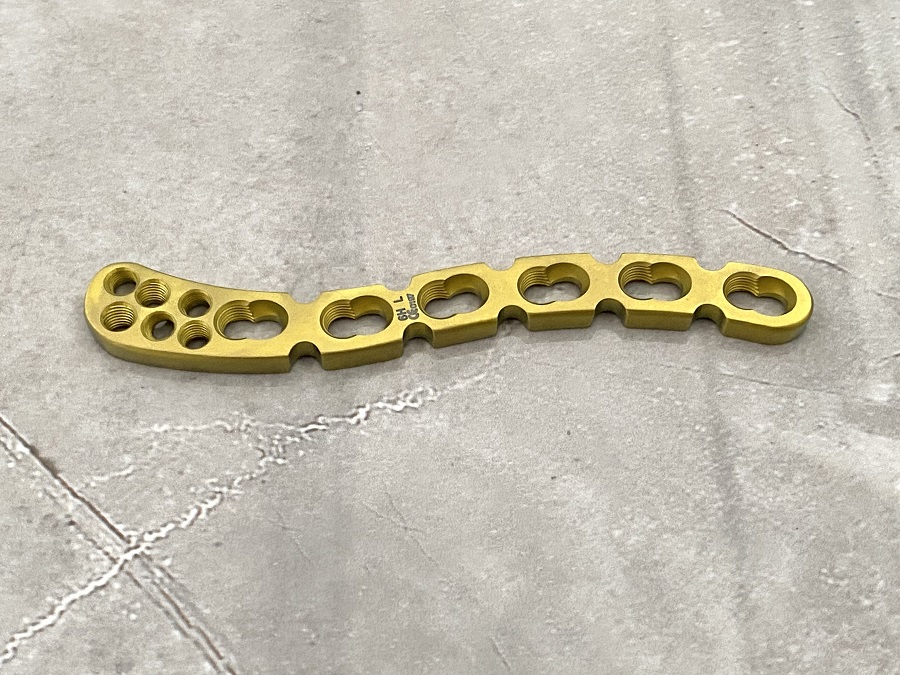 Plaque de verrouillage claviculaire distale