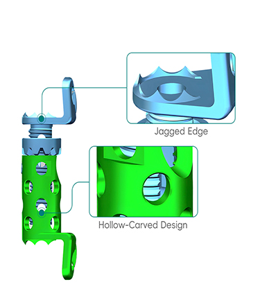chirurgie vert&eacute;brale cage-2