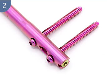 Expert R/Afn.Clou f&eacute;moral r&eacute;trograde/ant&eacute;rograde (2)