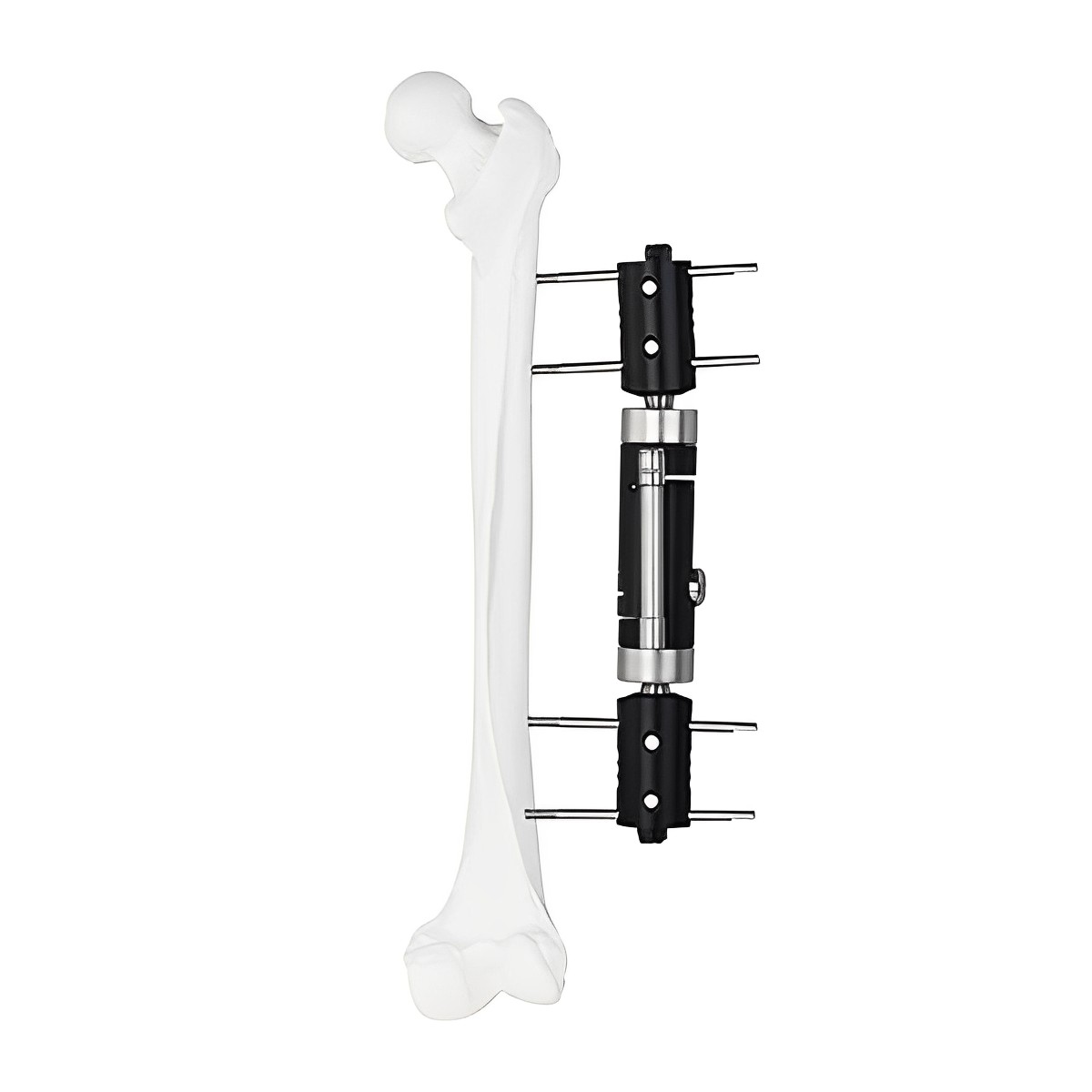 Fixateur multiaxial dynamique