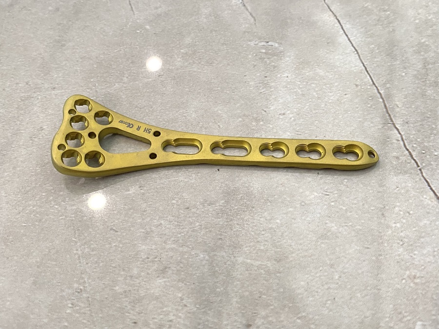 Plaque de verrouillage du radius distal VA