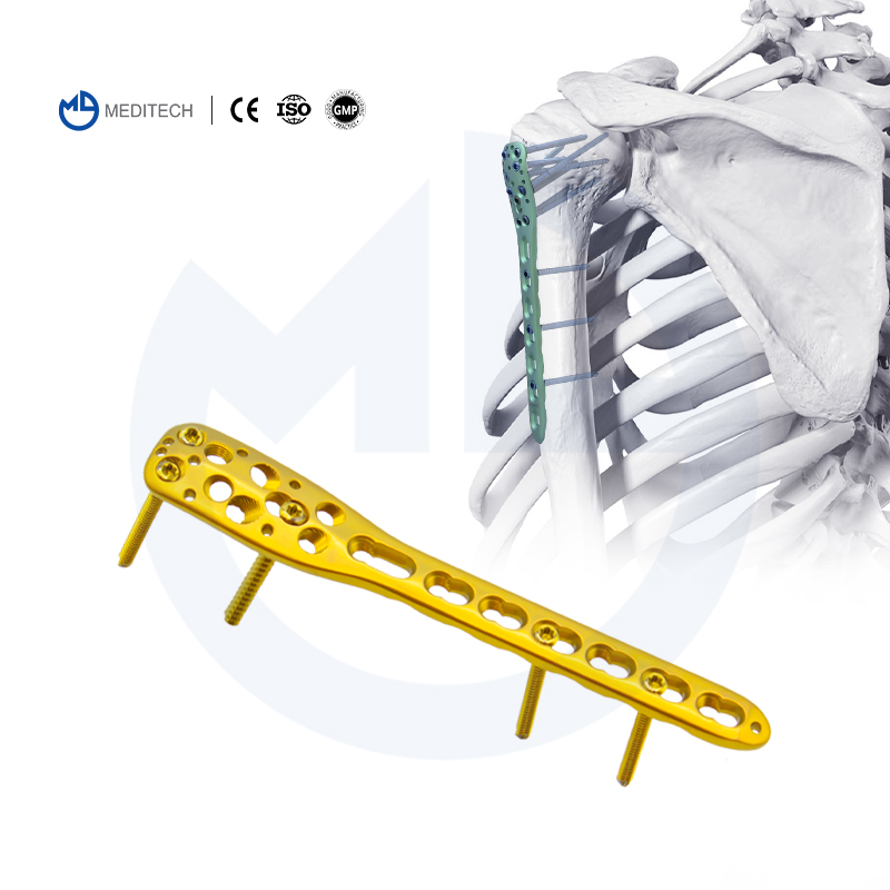 肱骨近端主图 -1