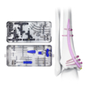 Ensemble d'instruments intramédullaire tibial distal (DTN)