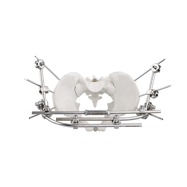 Fixateur pelvien