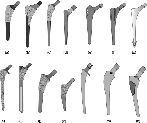 Types of femoral stem Types de tige fémorale