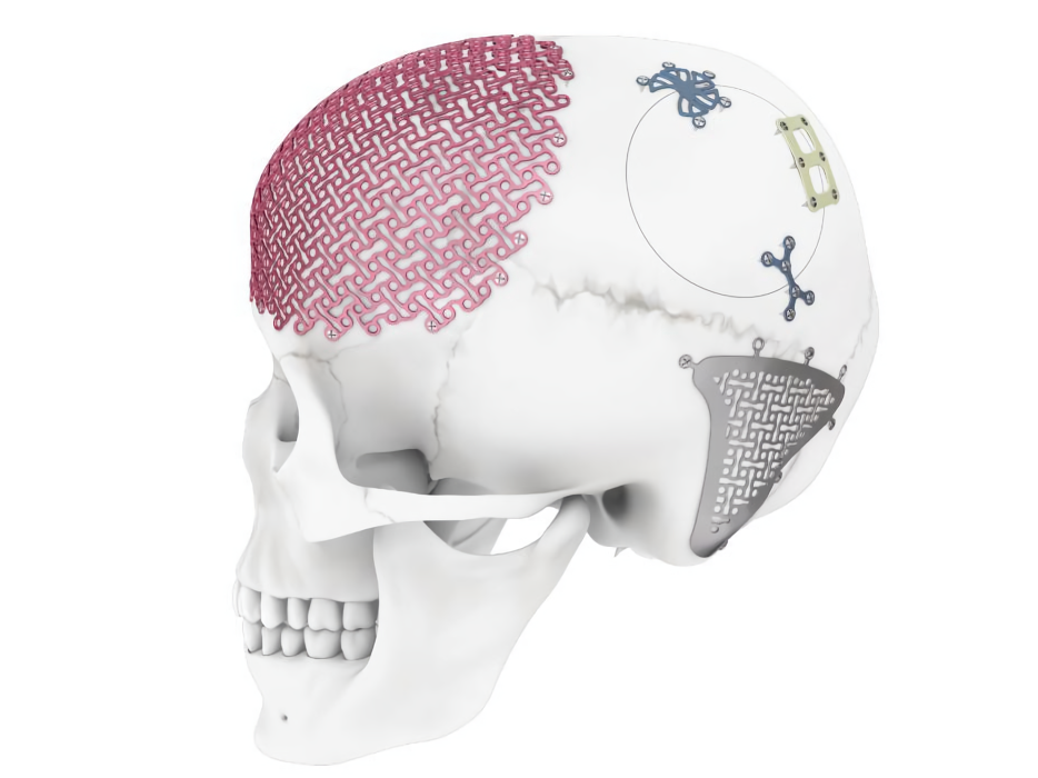 Qu\'est-ce que le CMF/Maxillo-facial ?