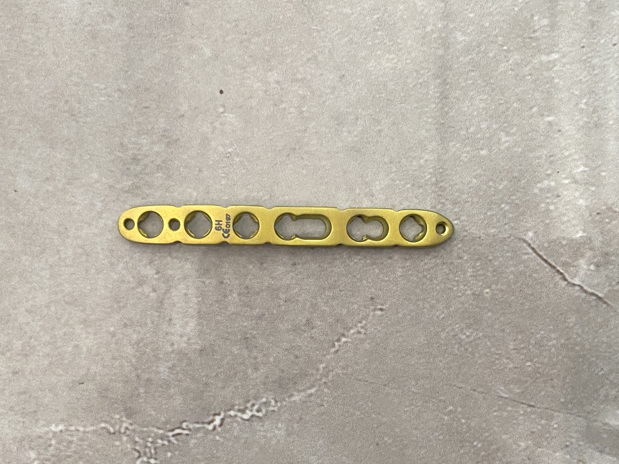 Plaque de verrouillage de rayon lat&eacute;ral distal VA