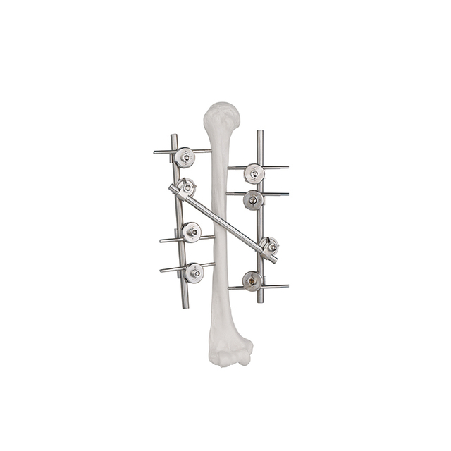 Fixateur externe du cadre huméral