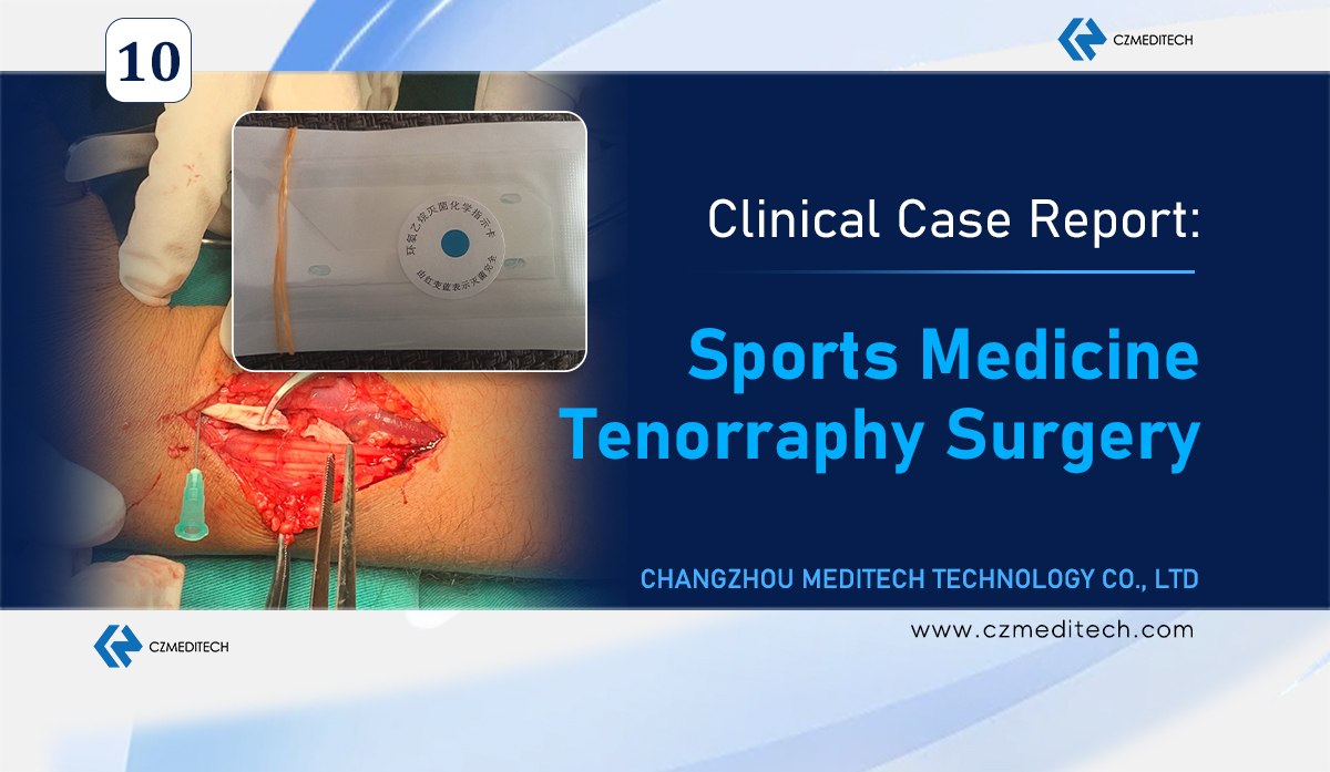 Étude de cas sur la médecine du sport | Chirurgie de ténorraphie réussie utilisant la suture UHMWPE au Pérou