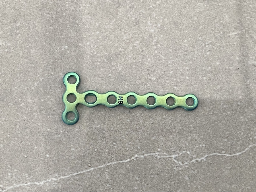 Plaque de verrouillage Mini T de 1,5 mm