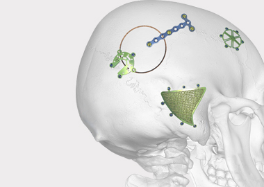 Système de placage neuro