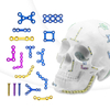 Système de plaques maxillofaciales de 1,5 mm