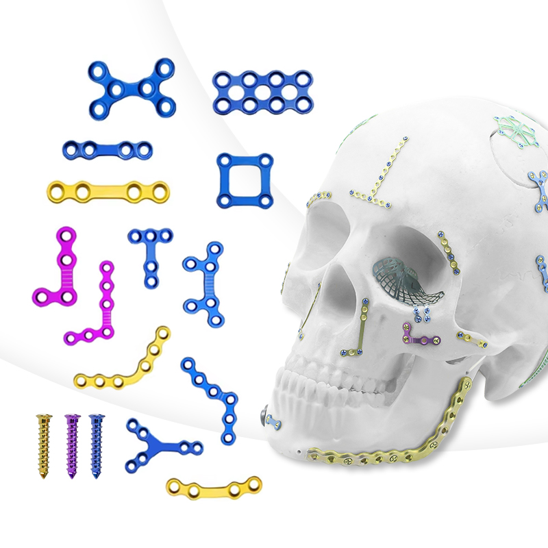 Système de plaques maxillofaciales de 1,5 mm