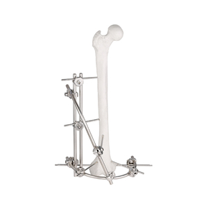 Fixateur externe condylien fémoral