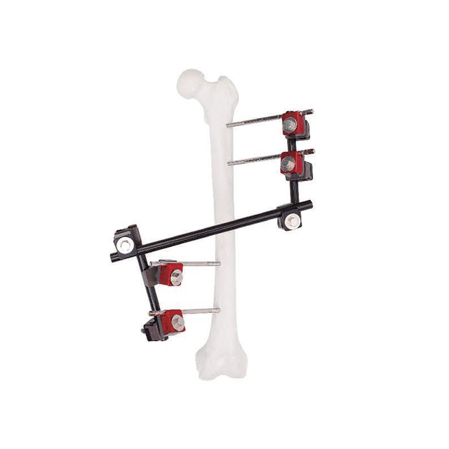 Couplage de broche / tige universelle