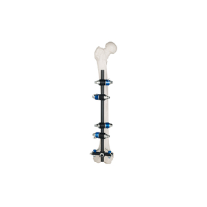 T Fixateur externe du cadre