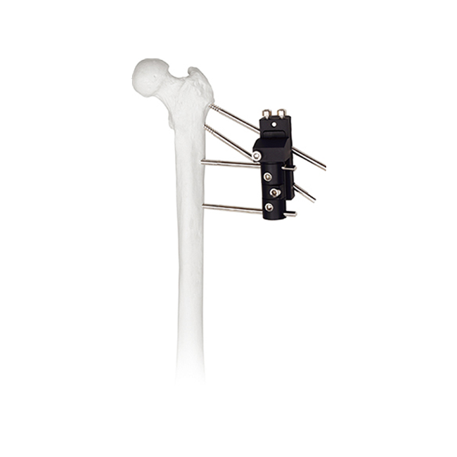 Fixateur externe à traction axiale dynamique de l'articulation de la hanche