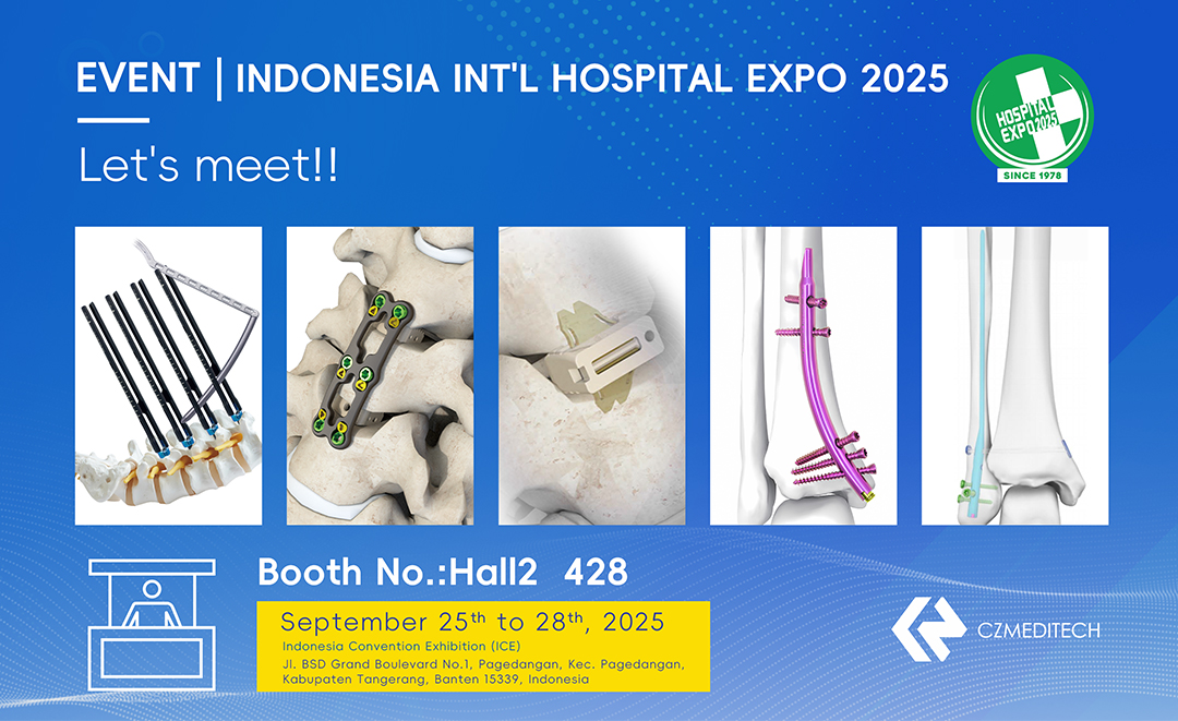Comment choisir le bon fournisseur d'appareils orthopédiques — Indonesia Hospital Expo Insights