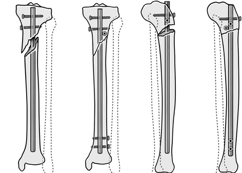 13037_2015_86_Fig10_HTML_副本