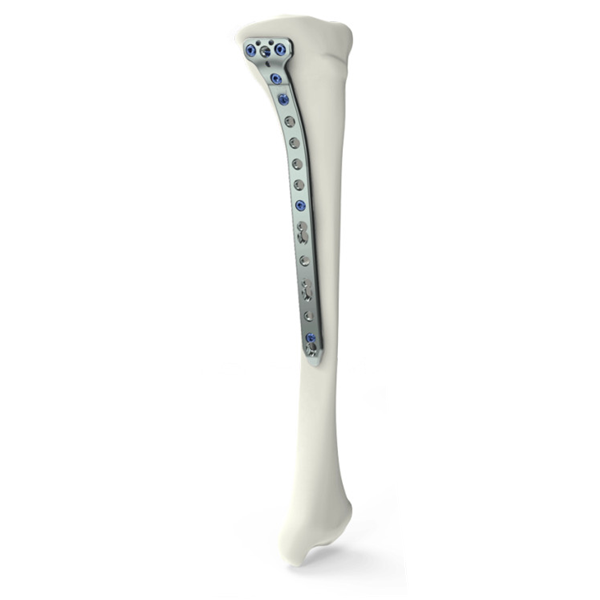 Plaque de verrouillage pour ostéotomie tibiale proximale médiale