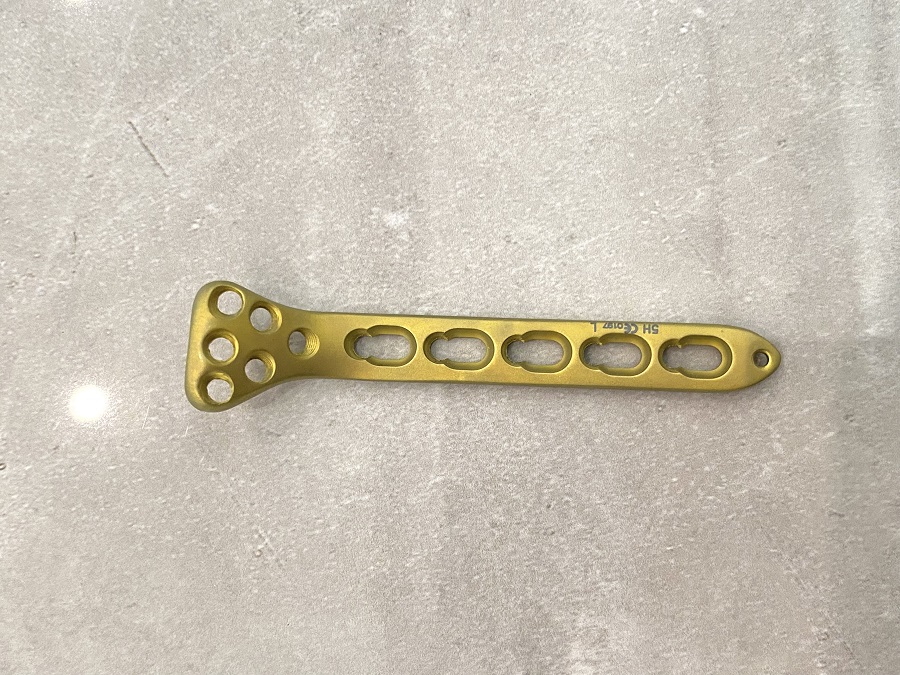 Plaque de verrouillage de rayon proximal