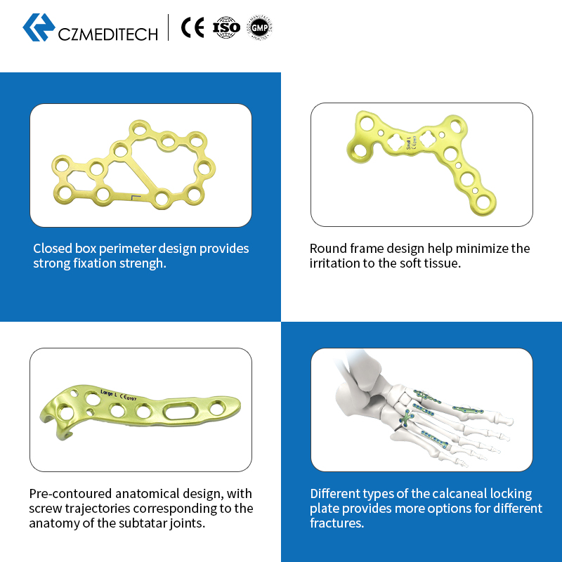 Plaque de verrouillage