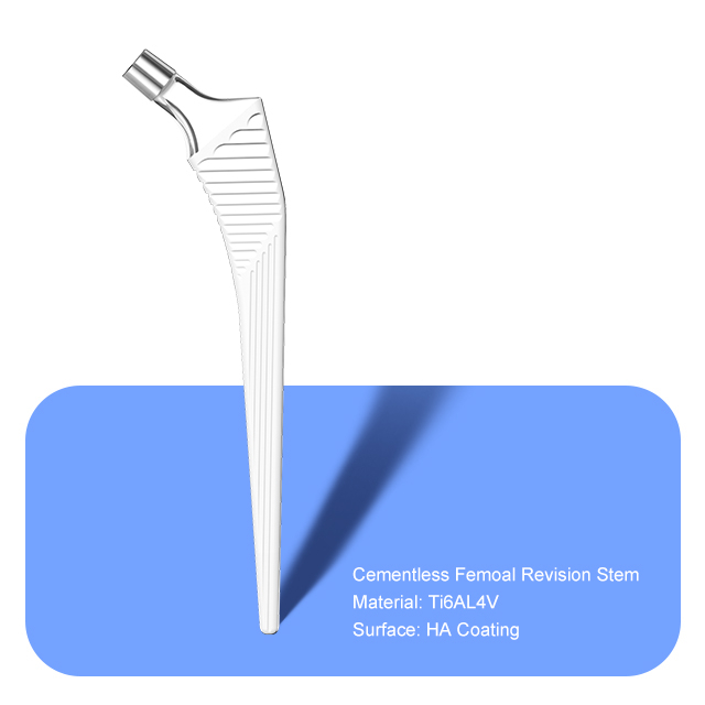 Tige de révision féminine sans ciment