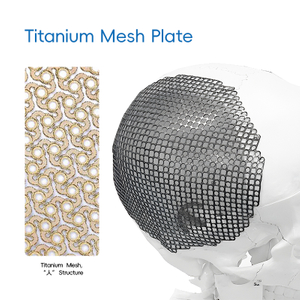 Titanium Mesh, 'λ ' Structure