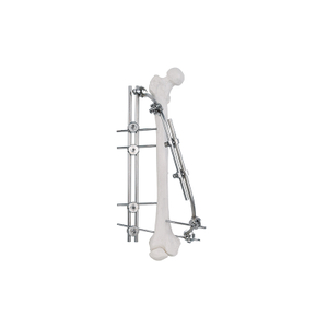 Fixateur externe de l'arbre fémoral 9100-2301