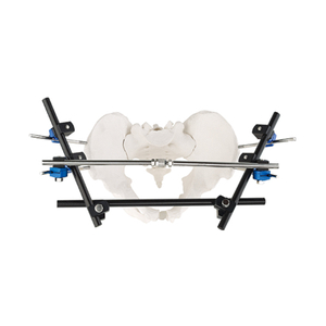 Fixateur externe pelvien