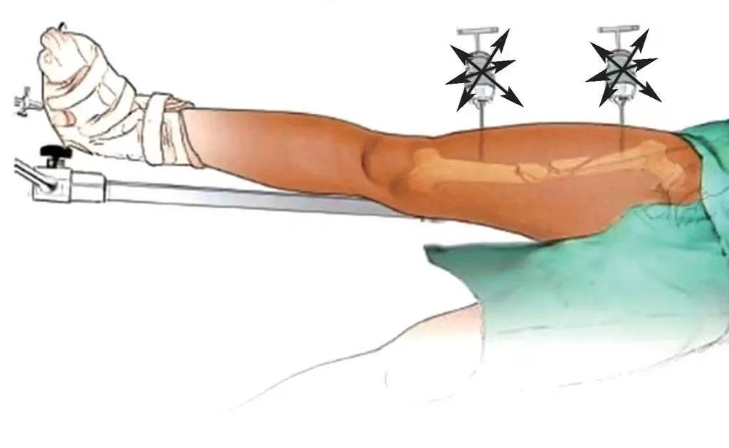 微信图片_20221208095850