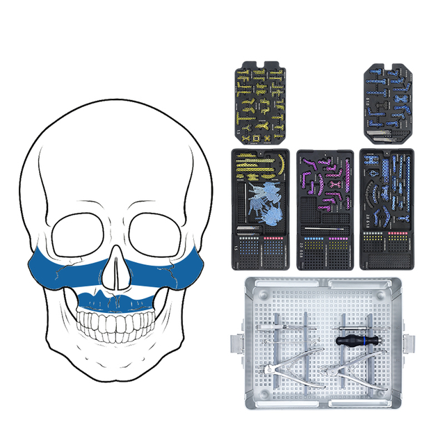 Système de plaque maxillo-facial de verrouillage de 1,5 mm 2,0 mm