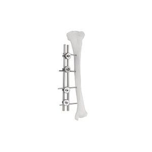 Fixateur externe côté unique à tige double