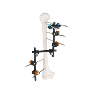Fixateur externe du cadre z (type t)