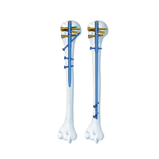 Clous Huméraux Multi-Loc