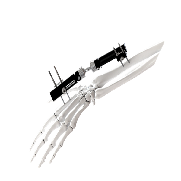 Fixateur externe des articulations du poignet - Type A