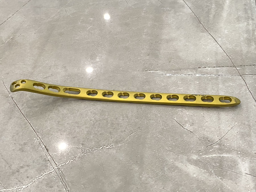 Plaque de verrouillage distale m&eacute;diale hum&eacute;rale