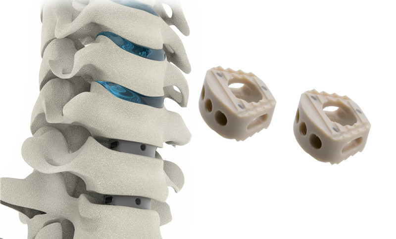 coup d'oeil - Ⅱ (2)_副本