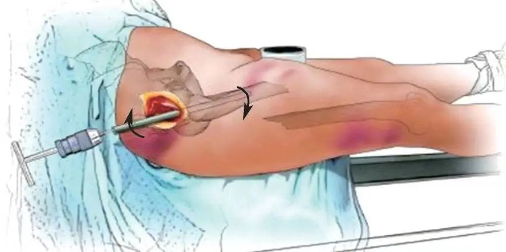 微信图片_20221208095758