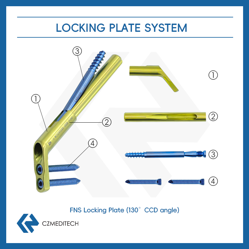 FNS (Système du col fémoral)