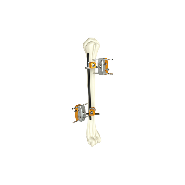 Fixateur externe de l'arbre huméral